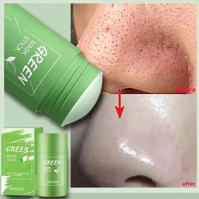 Dark Spots Remover Acne